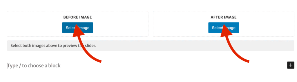 The Before-After Slider block right after it is added, with empty Before Image and After Image slots side by side. A red arrow points to the Select Image button in each slot. A message below reads, "Select both images above to preview the slider."